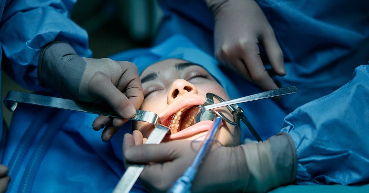 Cover Image for Dental Surgery Demystified: Everything You Need to Know for a Healthier Smile